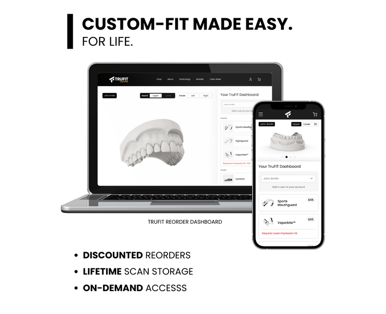 TRUFIT custom teeth whitening tray – clear 3D-printed dental-grade whitening tray